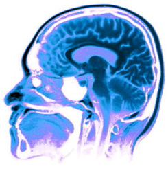 H5N1 may attack the brain